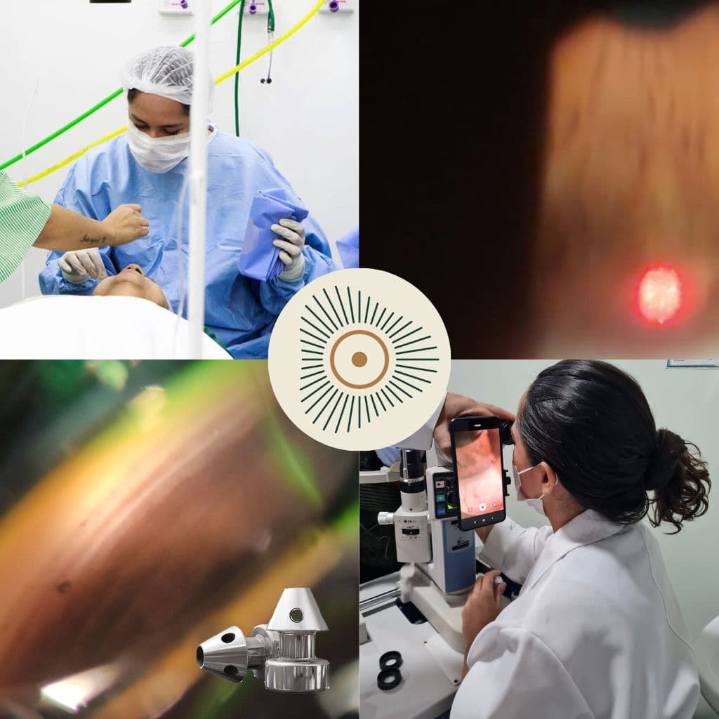 Tratamentos para glaucoma